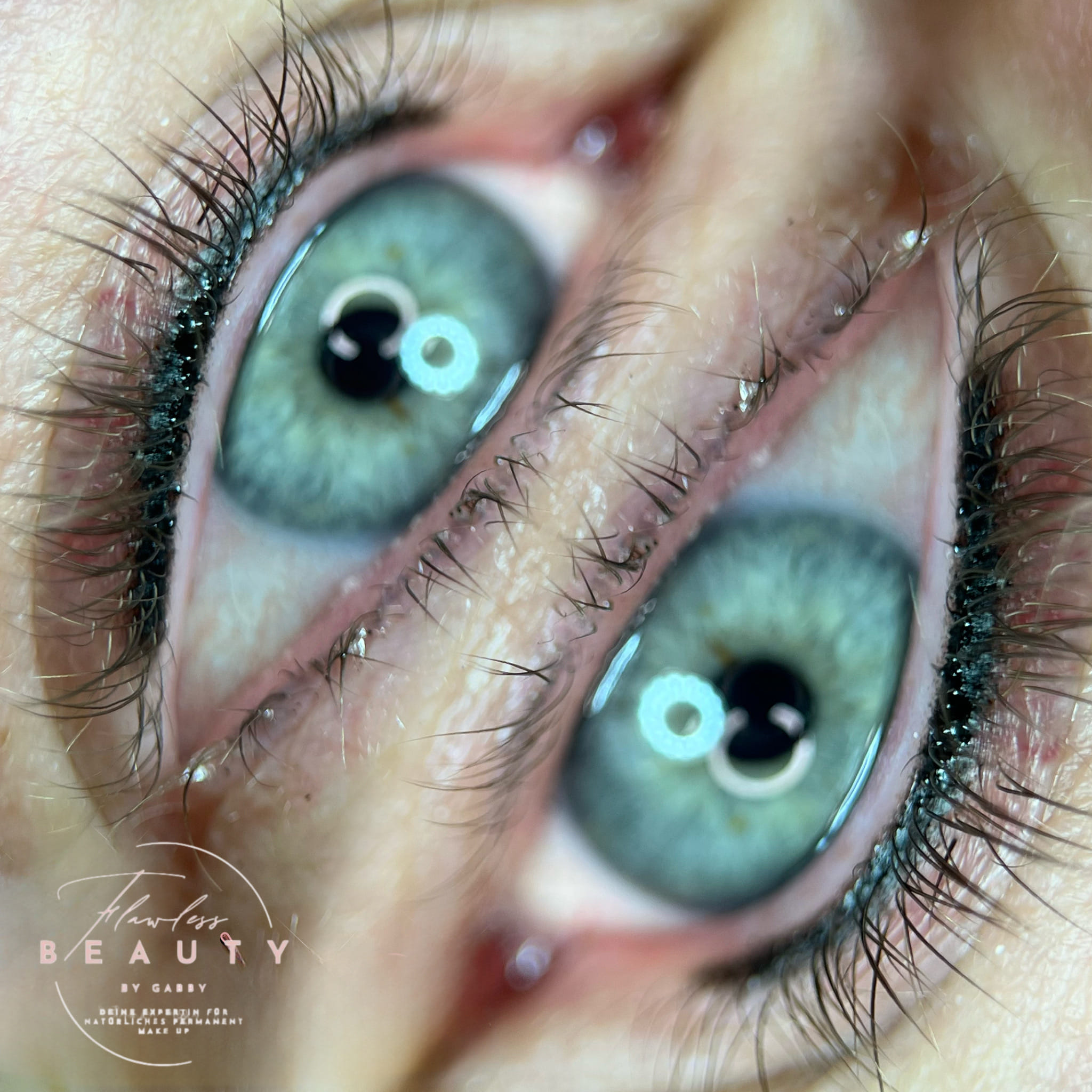 Softliner & Wimpernkranzverdichtung Ergebnis